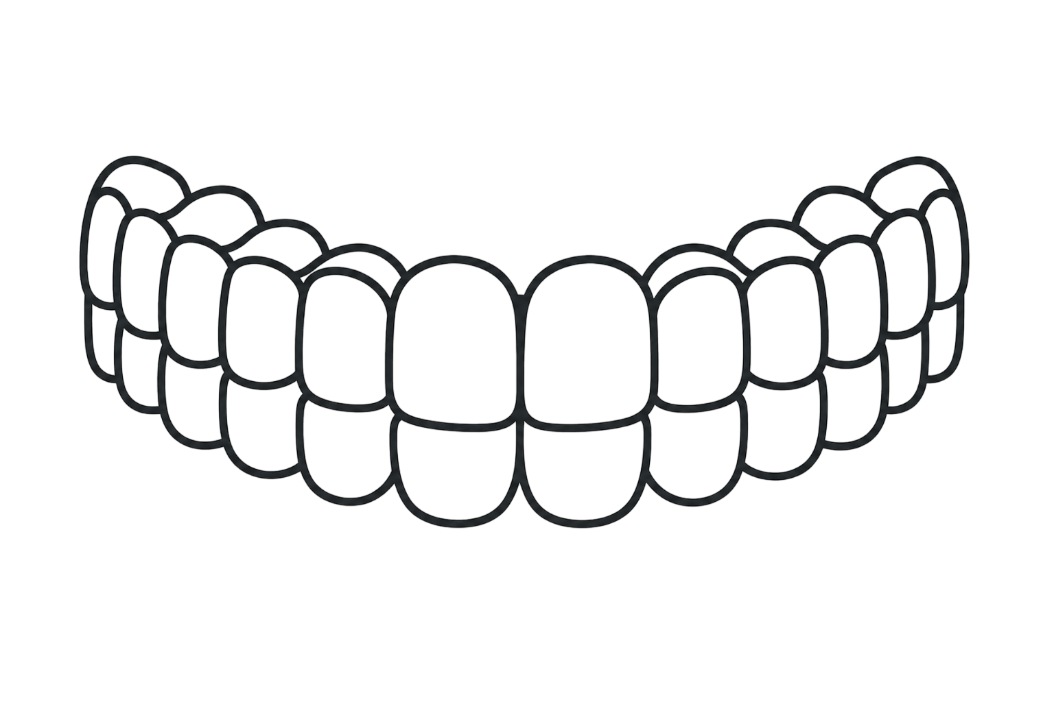 Diseño de sonrisa