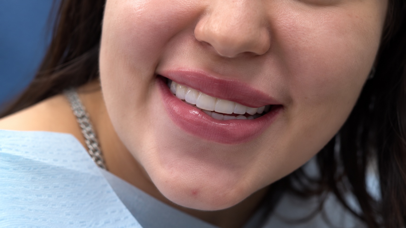 La sonrisa en detalle · Recreación editorial