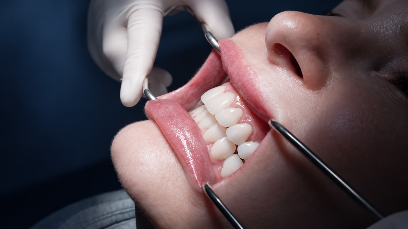 La dentadura en detalle · Recreación editorial