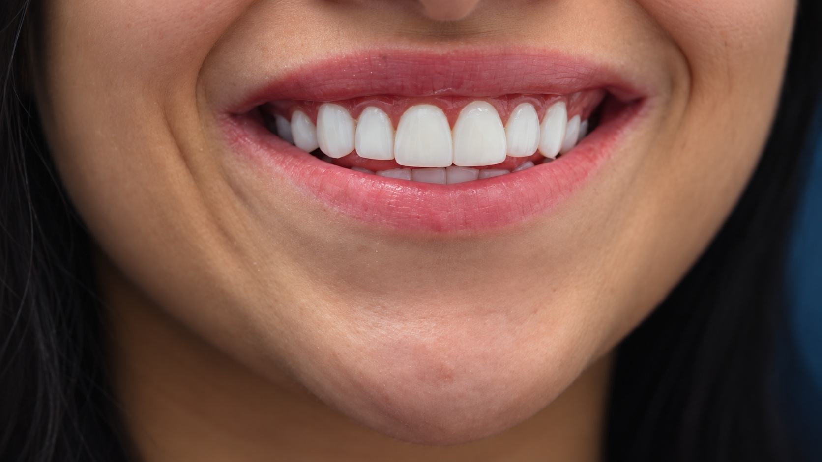 La sonrisa, de cerca · Recreación editorial