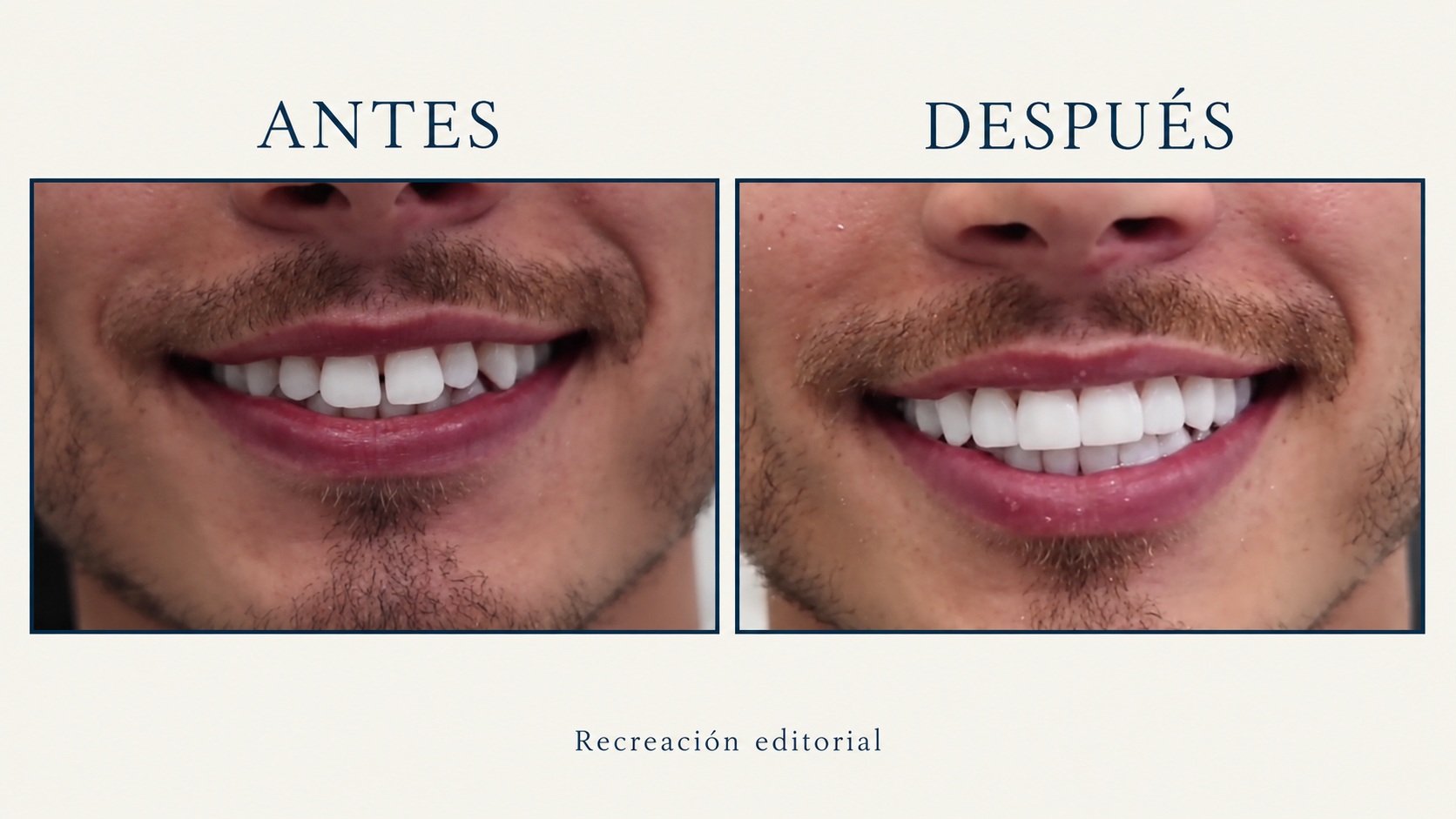 Antes y después · composición editorial